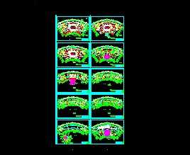 ĳ�칫¥�յ���װͼ